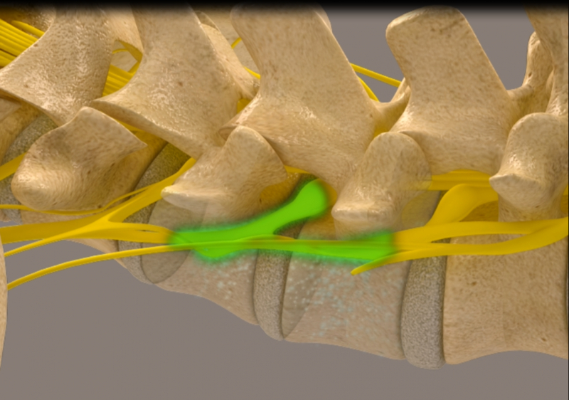 Stabilization Phase